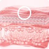 显示 Ultherapy PRIME 1.5mm 作用深度的皮肤结构示意图